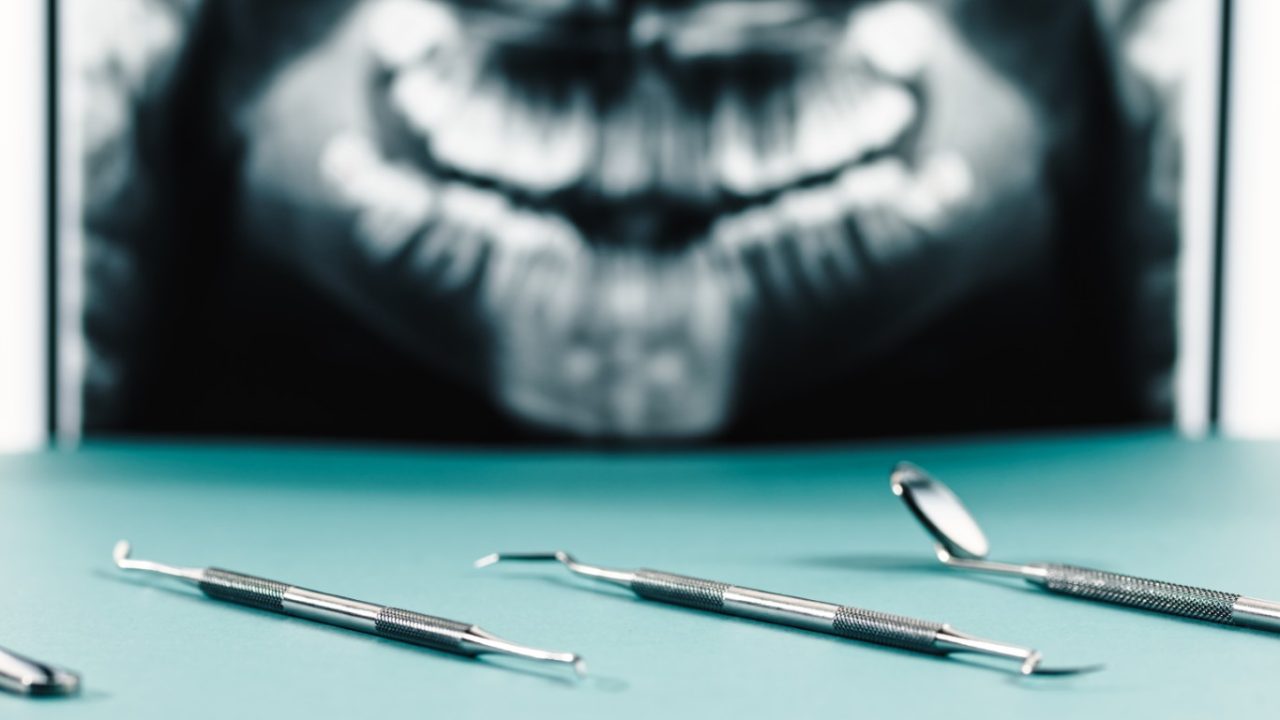 Si estás buscando un odontólogo en Coslada, es normal que quieras información clara antes de pedir cita. En Revident Dental Center trabajamos la salud bucodental desde una visión cercana