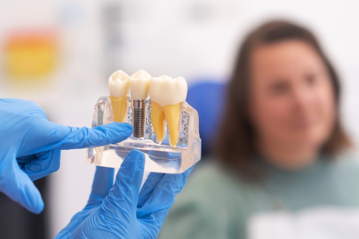 Implantes dentales con cirugía guiada en Coslada: operarte sabiendo el resultado antes de empezar